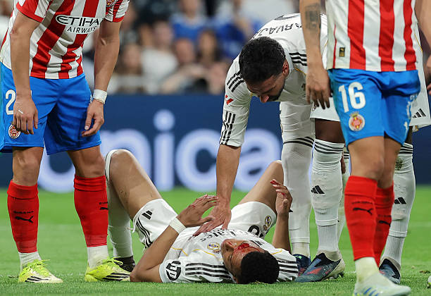 Mbappé con la frente abierta tras el codazo de Victor Reis (Foto de Thomas COEX / AFP via Getty Images)